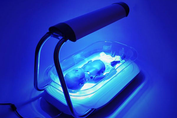 عوارض نور دستگاه زردی برای اطرافیان